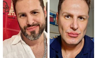 Bernardo Langlott surpreende ao retirar a barba e provoca reflexão sobre o “gay padrão”