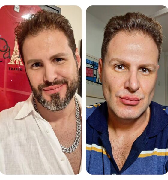 Bernardo Langlott surpreende ao retirar a barba e provoca reflexão sobre o “gay padrão”